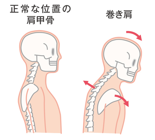 お役立ち情報「肩関節周囲炎（五十肩）の痛みと可動制限について 